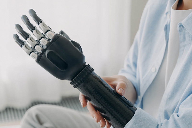 Bionic prosthesis